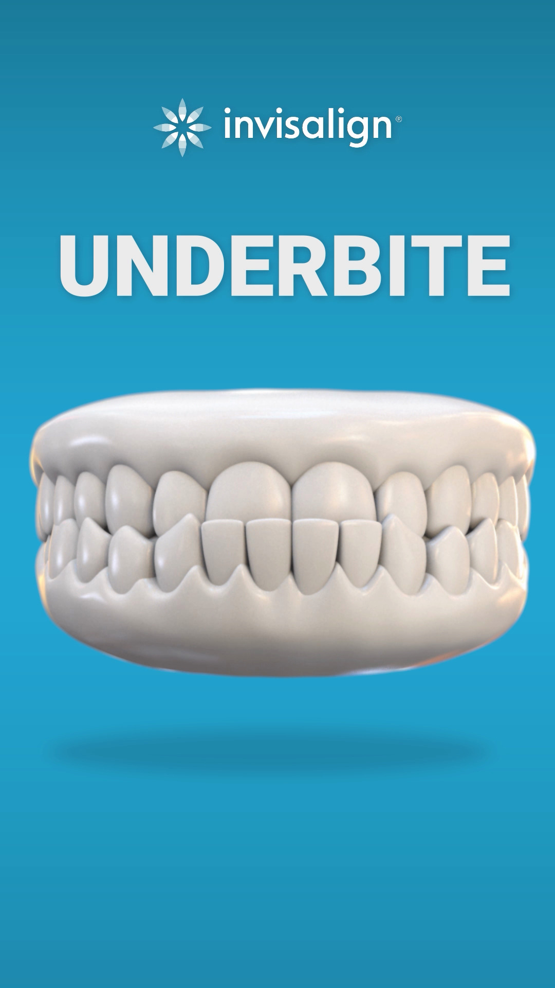 Invisalign Animation